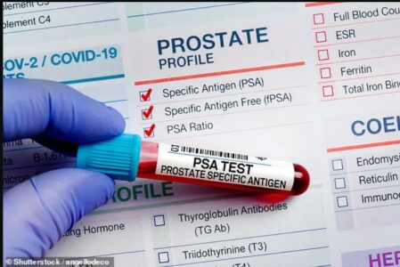 A mund të ndihmojë inteligjenca artificiale mjekët të marrin vendime më të mira për trajtimin e kancerit të prostatës?