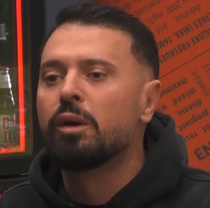 Labi e pranon: I kam bërë buzët botox – më pëlqejnë