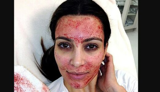 Trendi i çuditshëm i kujdesit për lëkurën: “Maska menstruale” – gratë vendosin gjakun e menstruacioneve në fytyrë… por a është i shëndetshëm?