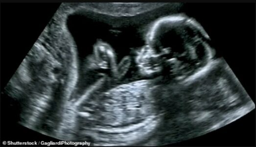 Alarm nga radiologët: Klinikat private po bëjnë eko për foshnjat me persona të patrajnuar