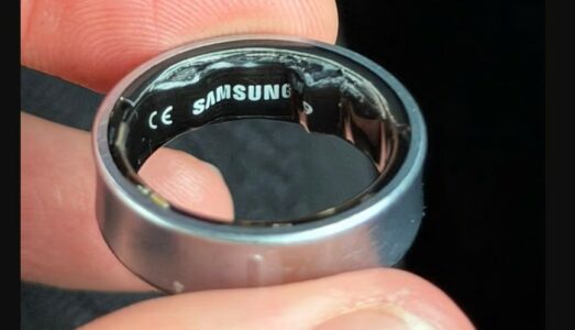 Përdoruesi i Samsung Galaxy Ring shkon në spital dhe nuk lejohet të hipë në fluturim pasi bateria e unazës fillon të fryhet