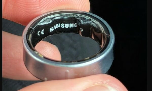 Përdoruesi i Samsung Galaxy Ring shkon në spital dhe nuk lejohet të hipë në fluturim pasi bateria e unazës fillon të fryhet